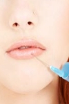 увеличение губ гиалуроновой кислотой