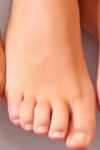 лечение грибка ногтей на ногах народными методами