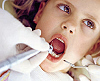 Пломбирование зубов - не бойтесь стоматолога 