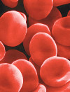 Как повысить гемоглобин - следите за питанием 