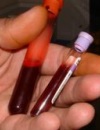 пониженные моноциты в крови