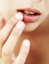 Советы для лечения потрескавшихся губ - что лучше: крем или бальзам? 