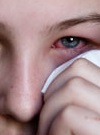 Признаки коньюнктивита: когда болеют глаза 