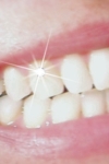 стразы на зубы