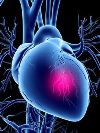 Синусовая тахикардия: нарушение работы сердца 