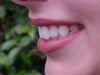 Съемное протезирование - можно ли привыкнуть к чужим зубам? 