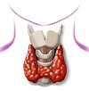 Щитовидная железа - отвечает за ваши гормоны 