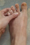 зуд между пальцами ног
