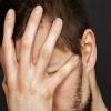 Хламидиоз у мужчин - характерны слабо выраженные симптомы