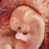 Ранний и поздний аборты: особенности и различия