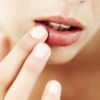 Советы для лечения потрескавшихся губ - что лучше: крем или бальзам?