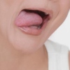 Повышенная кислотность во рту – проблемы с желудочно-кишечным трактом