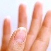 Белые пятна на ногтях – в чем причины и какие меры предпринять