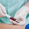 С-реактивный белок: анализ крови расскажет о проблемах