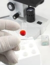Биохимический анализ крови - для диагностики и контроля 